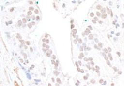Detection of human FBW7 by immunohistochemistry.