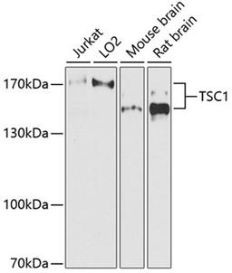 Western blot - TSC1 antibody (A0720)