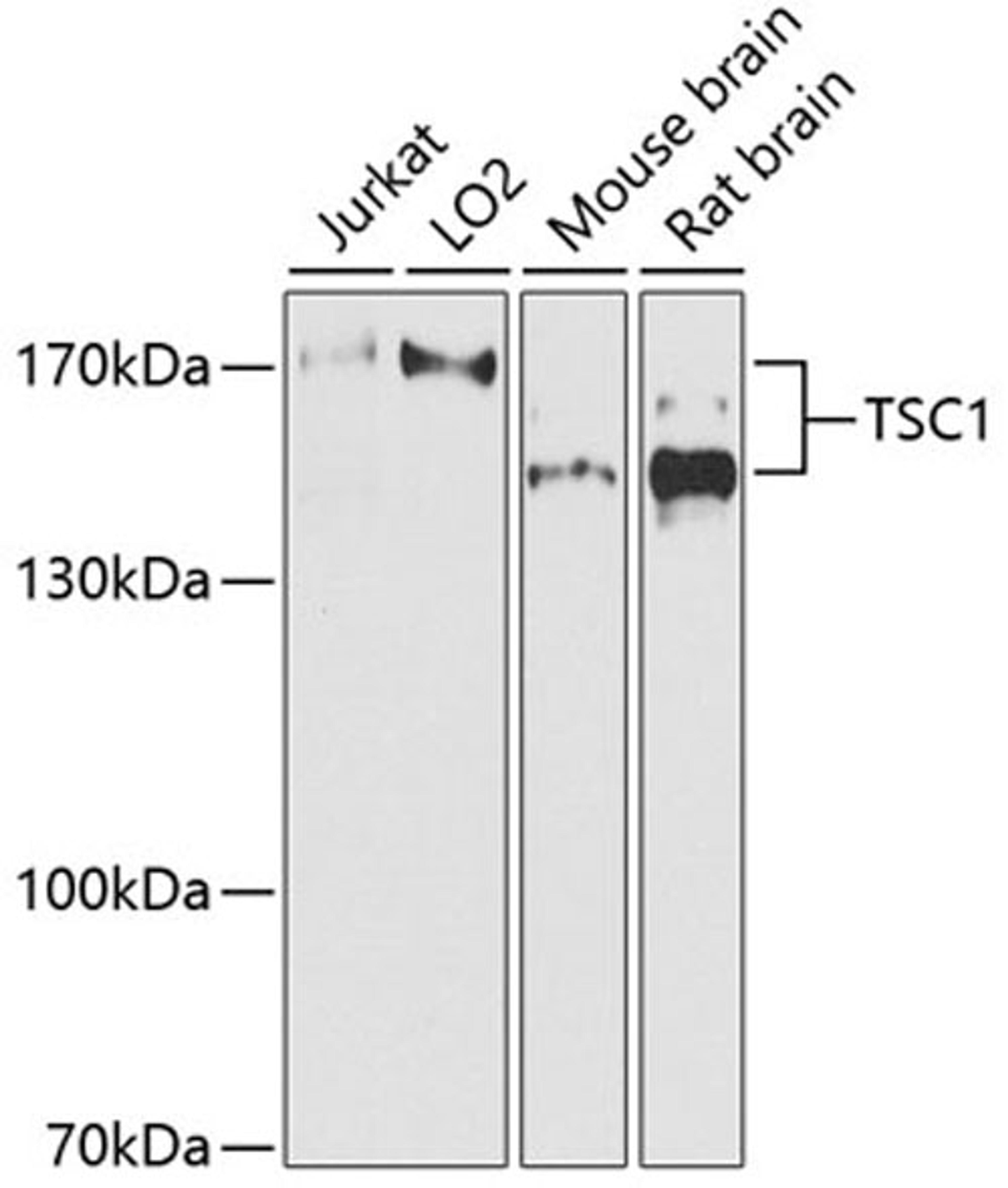 Western blot - TSC1 antibody (A0720)