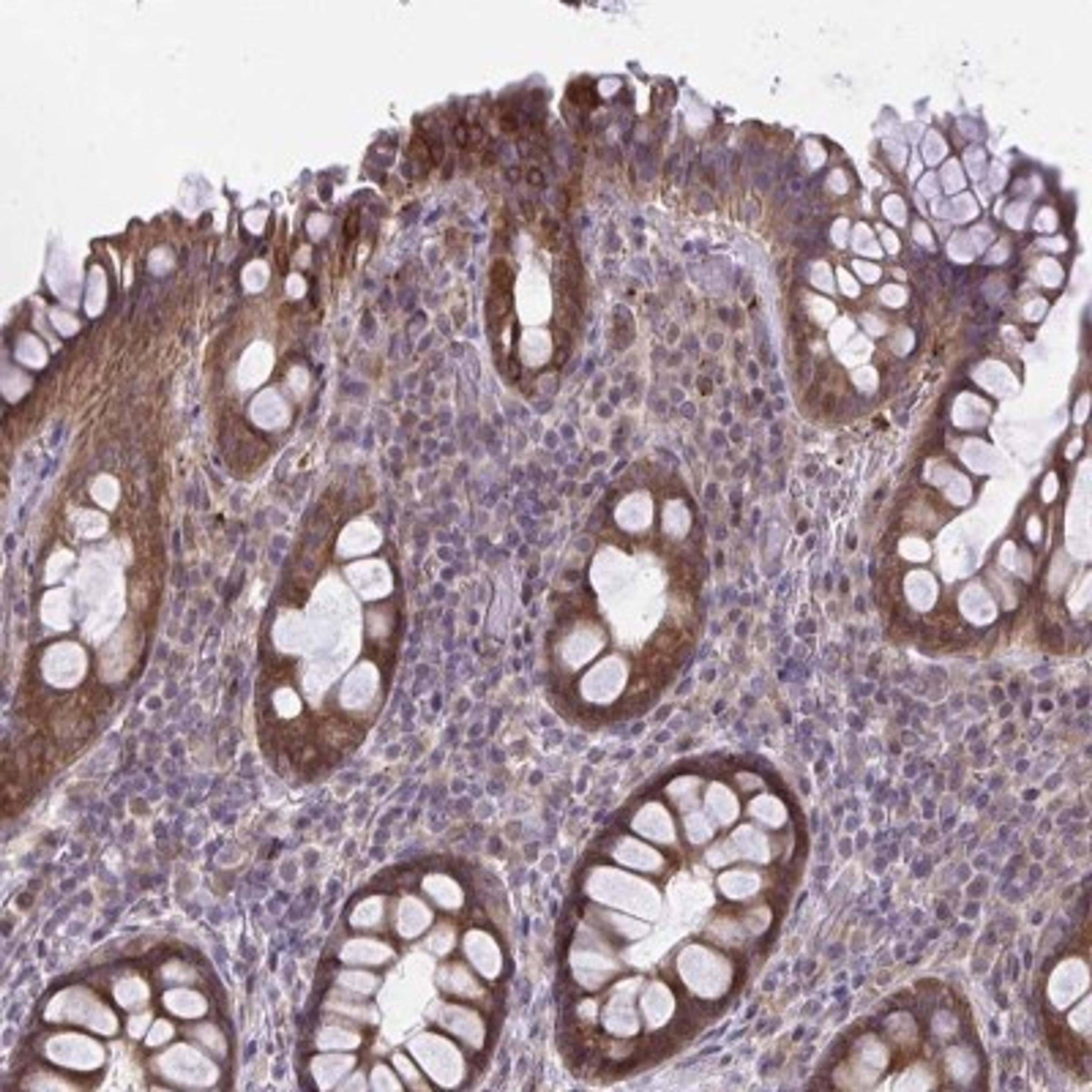 Immunohistochemistry: SLC9A11 Antibody [NBP2-31744] - Staining of human rectum shows moderate cytoplasmic positivity in glandular cells.