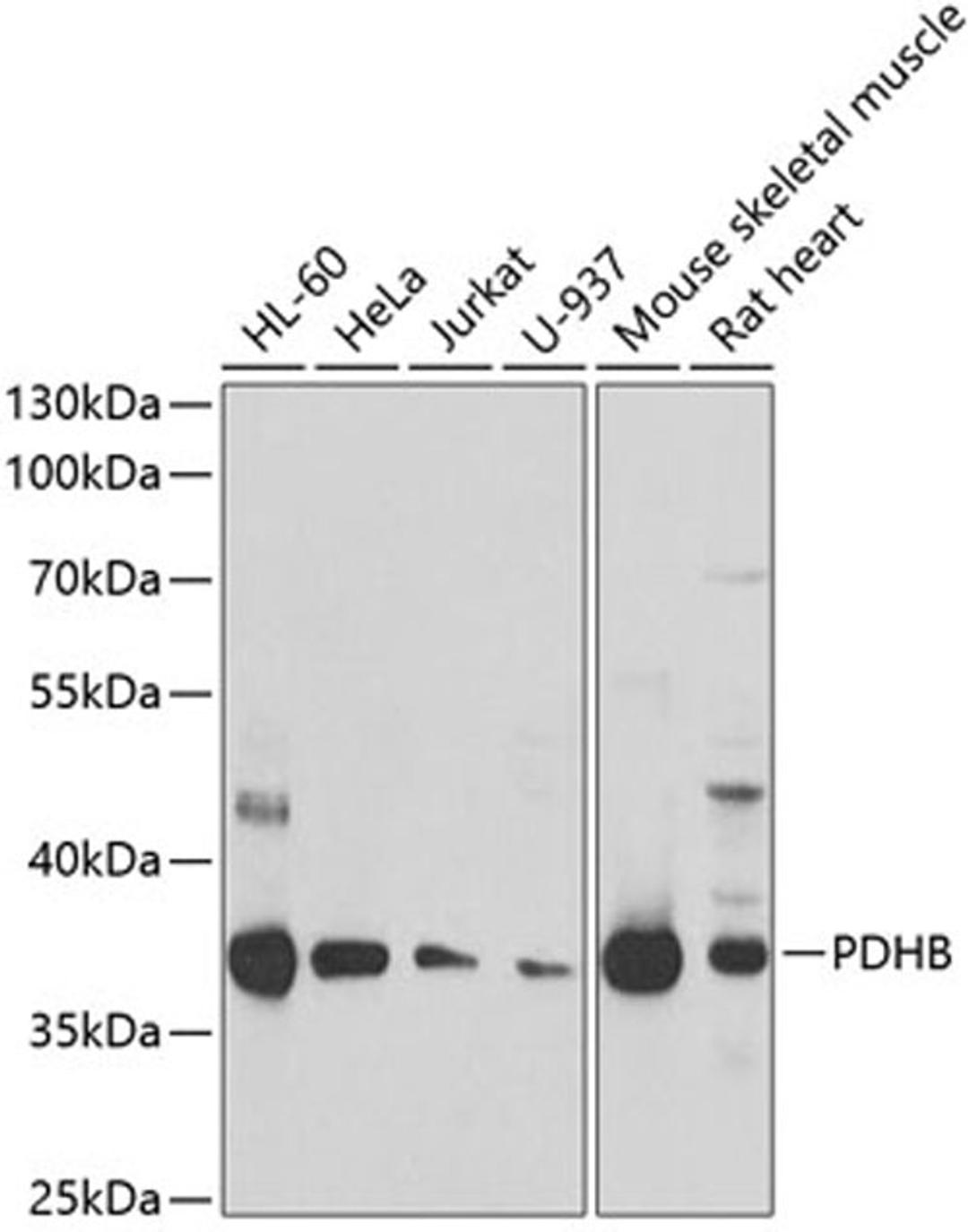 Western blot - PDHB antibody (A6943)