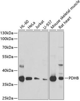 Western blot - PDHB antibody (A6943)