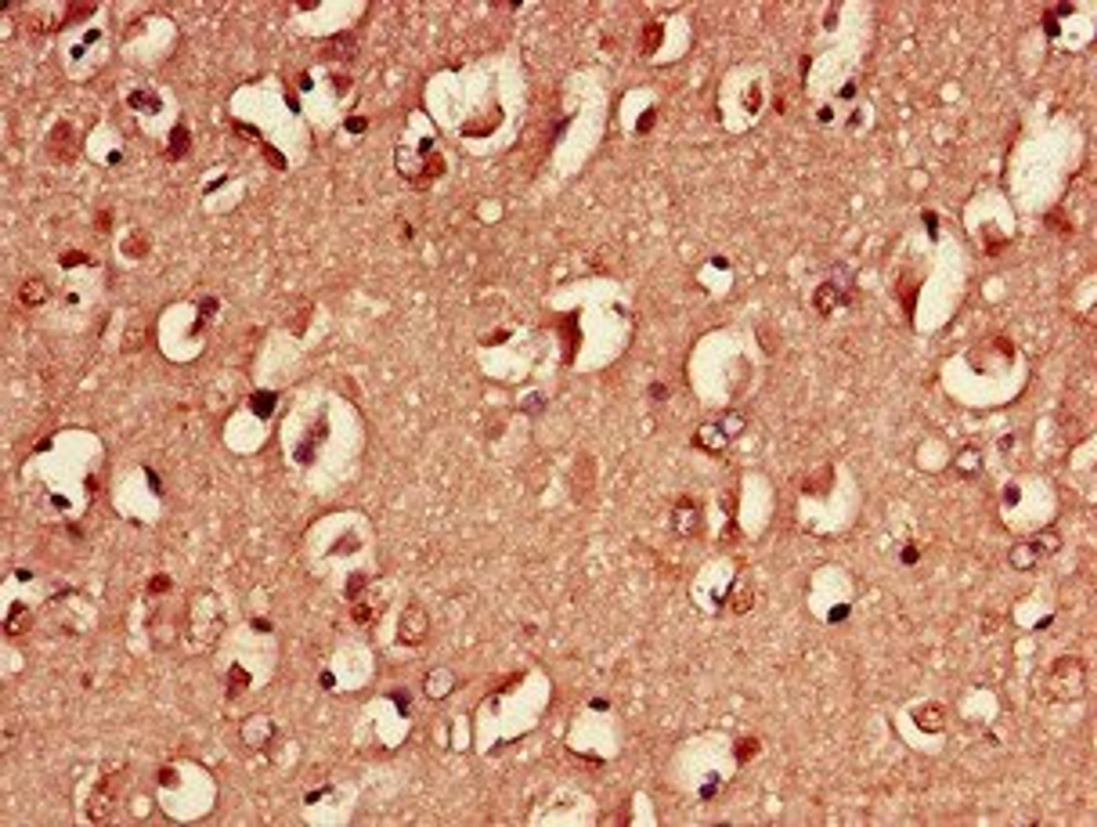 Immunohistochemical staining of human brain tissue using 14-3-3 protein eta antibody (Biotin)