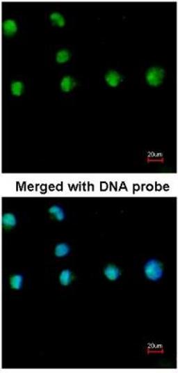 Immunocytochemistry/Immunofluorescence: COUP-TF I/NR2F1 Antibody [NBP1-31259] - Analysis of HeLa, using COUP TF1 antibody at 1:200 dilution.