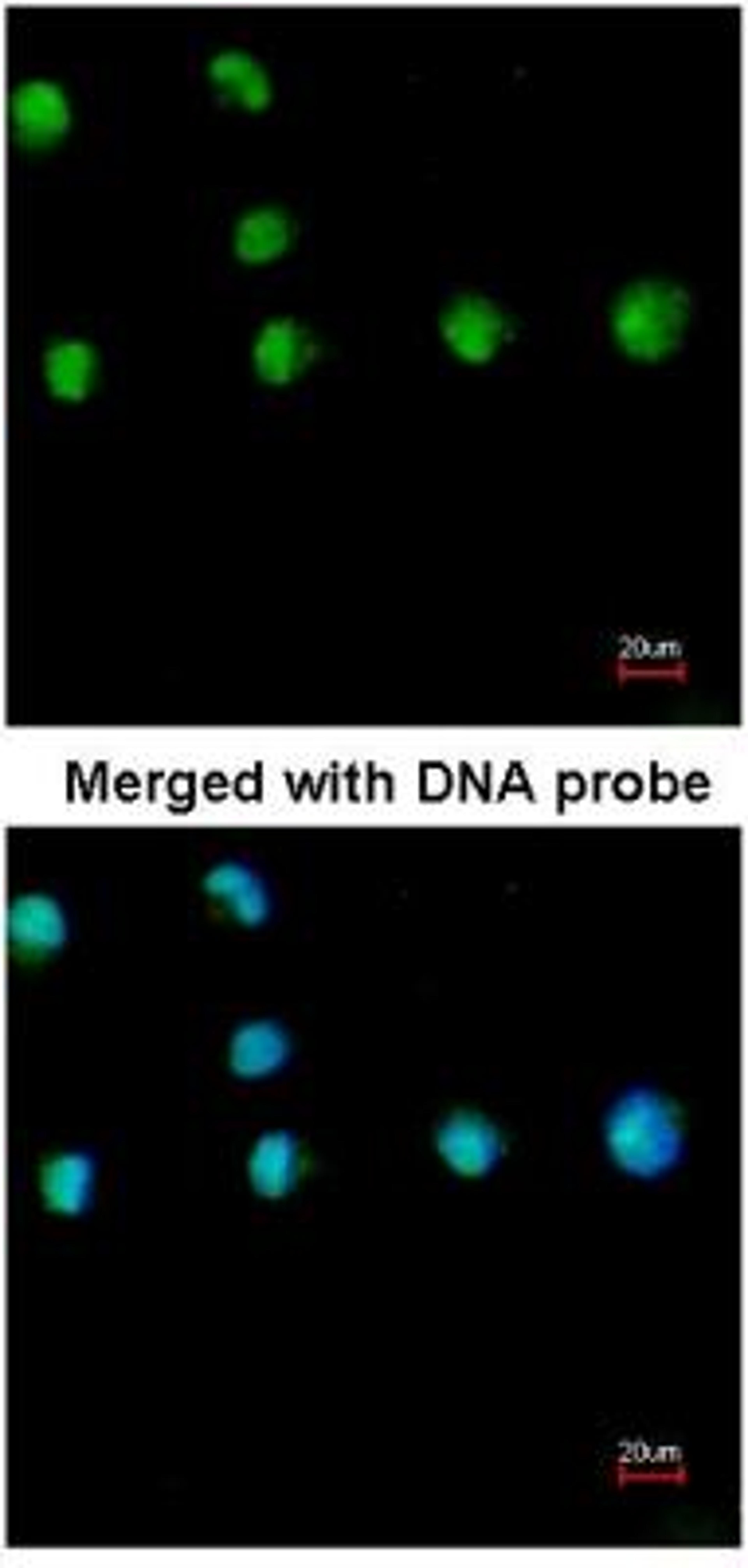 Immunocytochemistry/Immunofluorescence: COUP-TF I/NR2F1 Antibody [NBP1-31259] - Analysis of HeLa, using COUP TF1 antibody at 1:200 dilution.