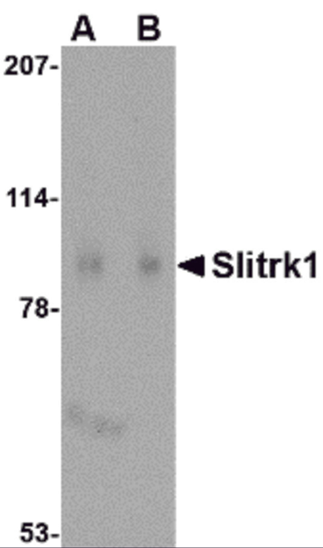 Western blot analysis of Slitrk1 in human brain tissue lysate with Slitrk1 antibody at (A) 1 and (B) 2 μg/mL.