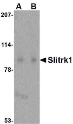 Western blot analysis of Slitrk1 in human brain tissue lysate with Slitrk1 antibody at (A) 1 and (B) 2 μg/mL.
