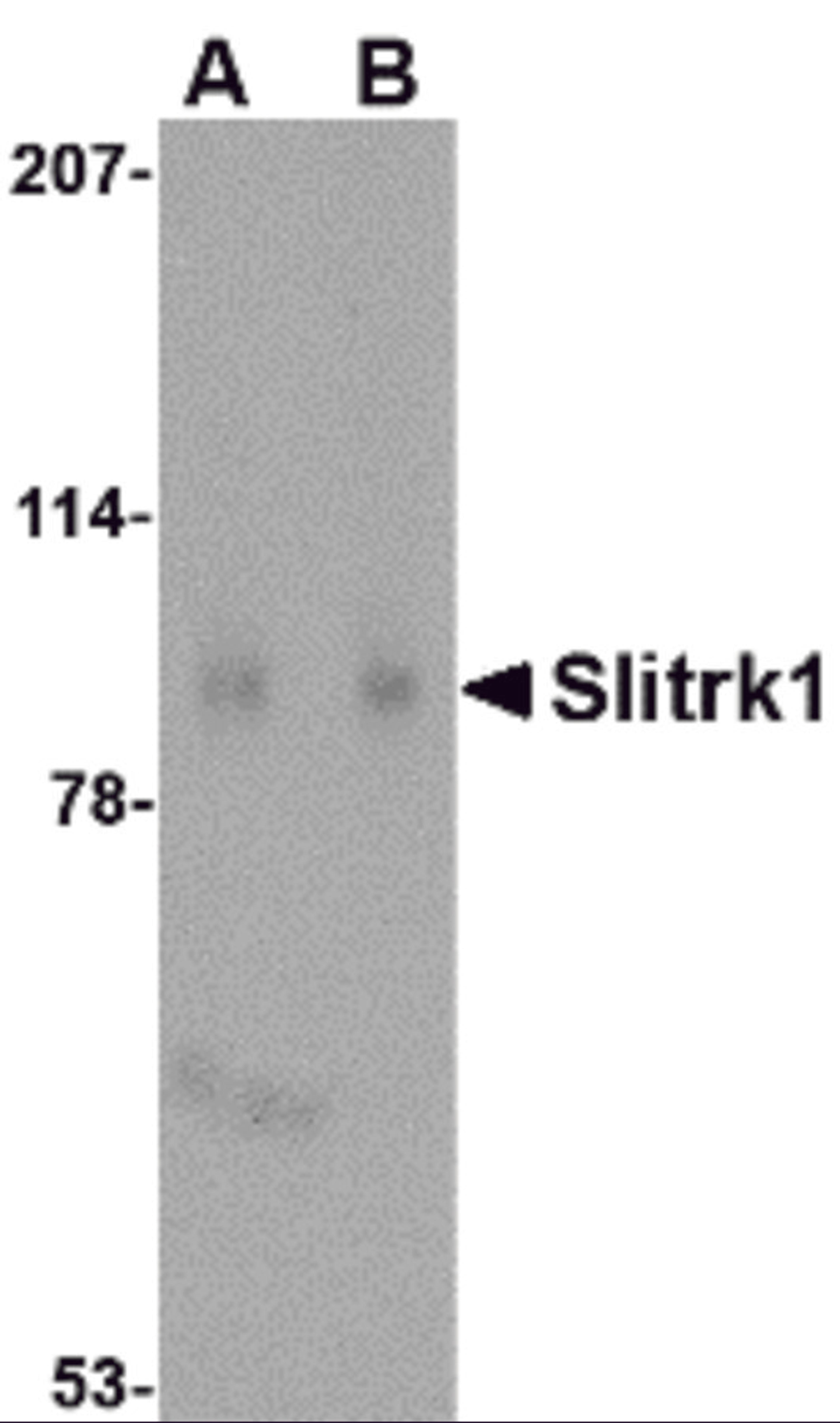 Western blot analysis of Slitrk1 in human brain tissue lysate with Slitrk1 antibody at (A) 1 and (B) 2 μg/mL.