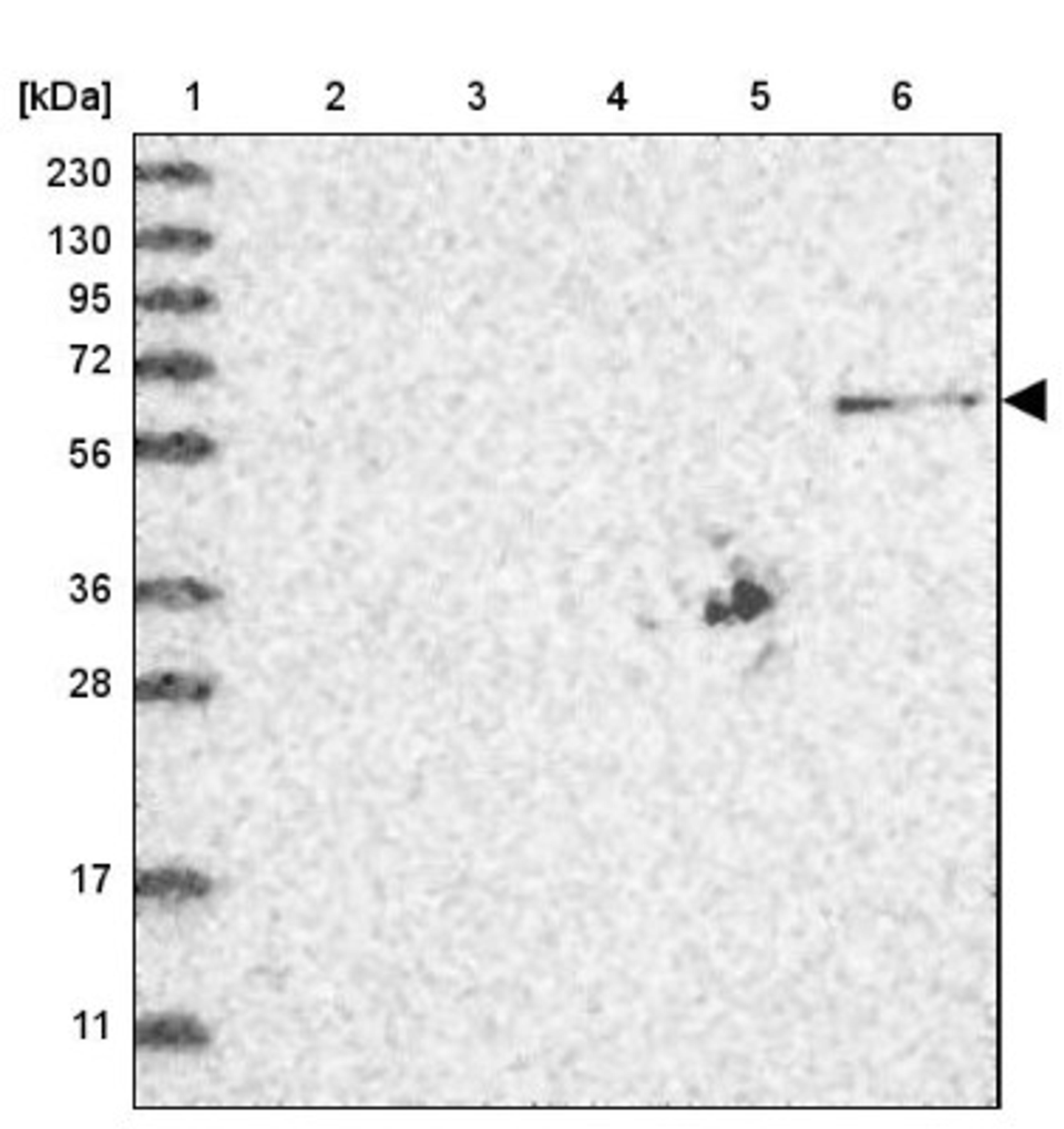 Western Blot: ZNF677 Antibody [NBP1-82677] - Lane 1: Marker [kDa] 230, 130, 95, 72, 56, 36, 28, 17, 11<br/>Lane 2: Human cell line RT-4<br/>Lane 3: Human cell line U-251MG sp<br/>Lane 4: Human plasma (IgG/HSA depleted)<br/>Lane 5: Human liver tissue<br/>Lane 6: Human tonsil tissue