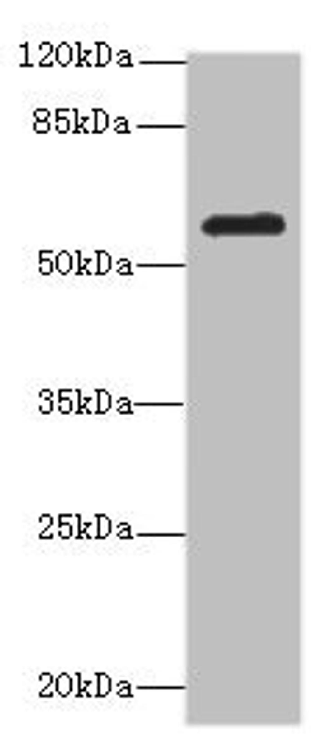 Western blot. All lanes: MMP19antibody at 2.58ug/ml + Mouse lung tissue. Secondary. Goat polyclonal to rabbit IgG at 1/10000 dilution. Predicted band size: 58, 26, 7, 34 kDa. Observed band size: 58 kDa.