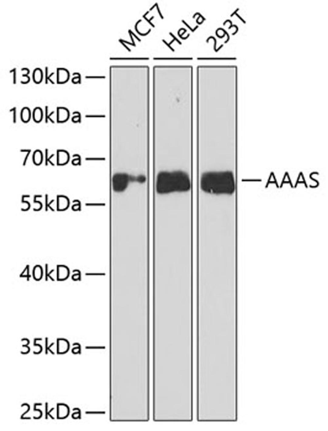 Western blot - AAAS antibody (A6427)