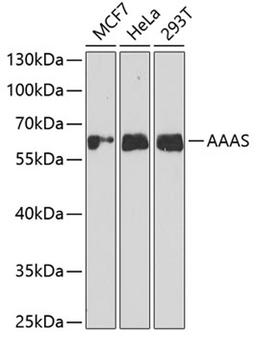 Western blot - AAAS antibody (A6427)