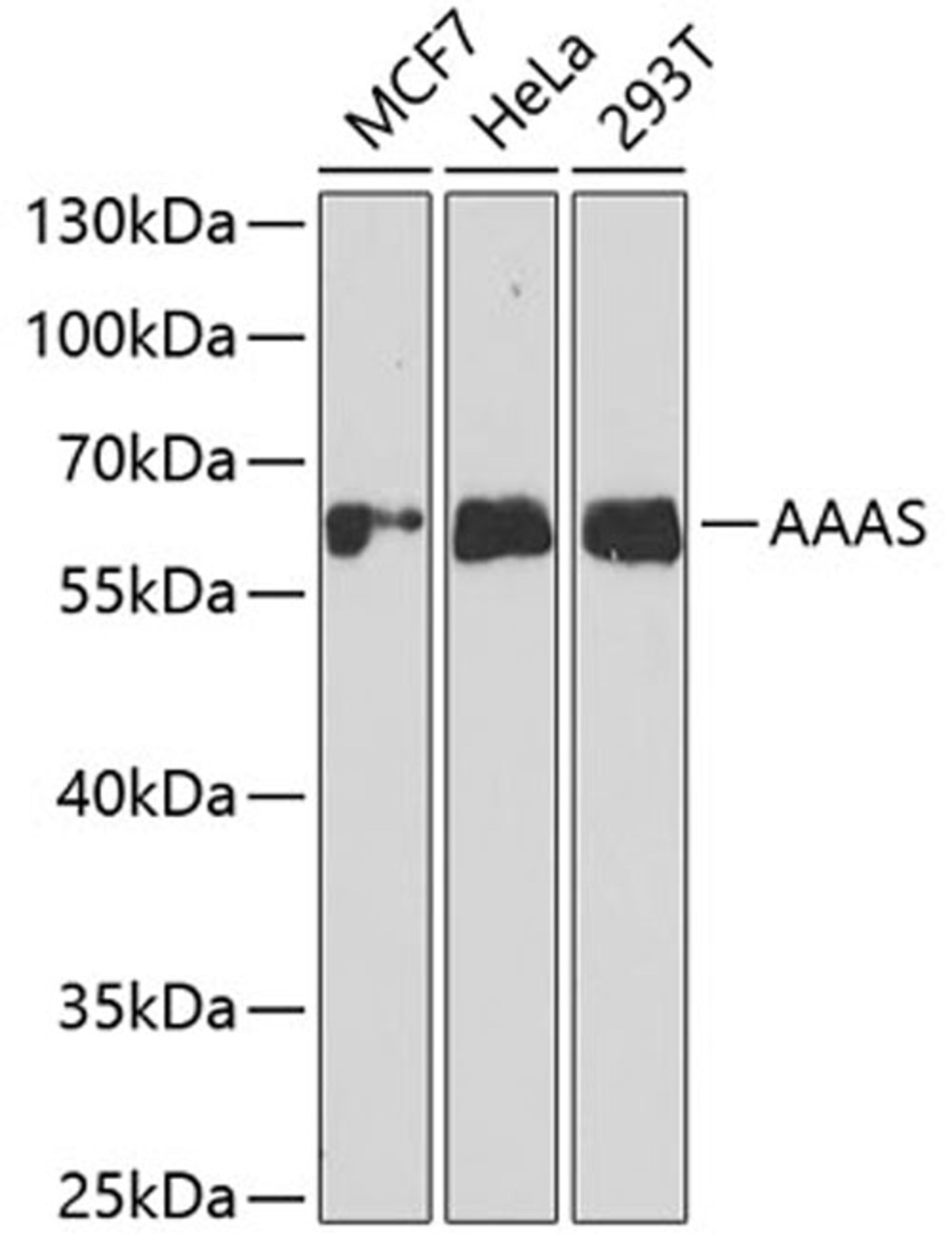 Western blot - AAAS antibody (A6427)