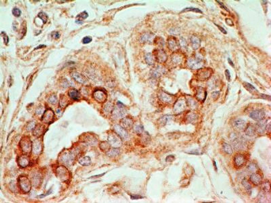 Immunohistochemistry-Paraffin: CD47 Antibody (B6H12.2) [Azide Free] [NBP2-31106] - IHC analysis of formalin-fixed paraffin-embedded tissue section of human normal breast using mouse monoclonal CD47 antibody (clone B6H12.2) at 0.5ug/ml concentration. The ductal/acinar epithelial cells in the breast section developed specific membrane-cytoplasmic staining.