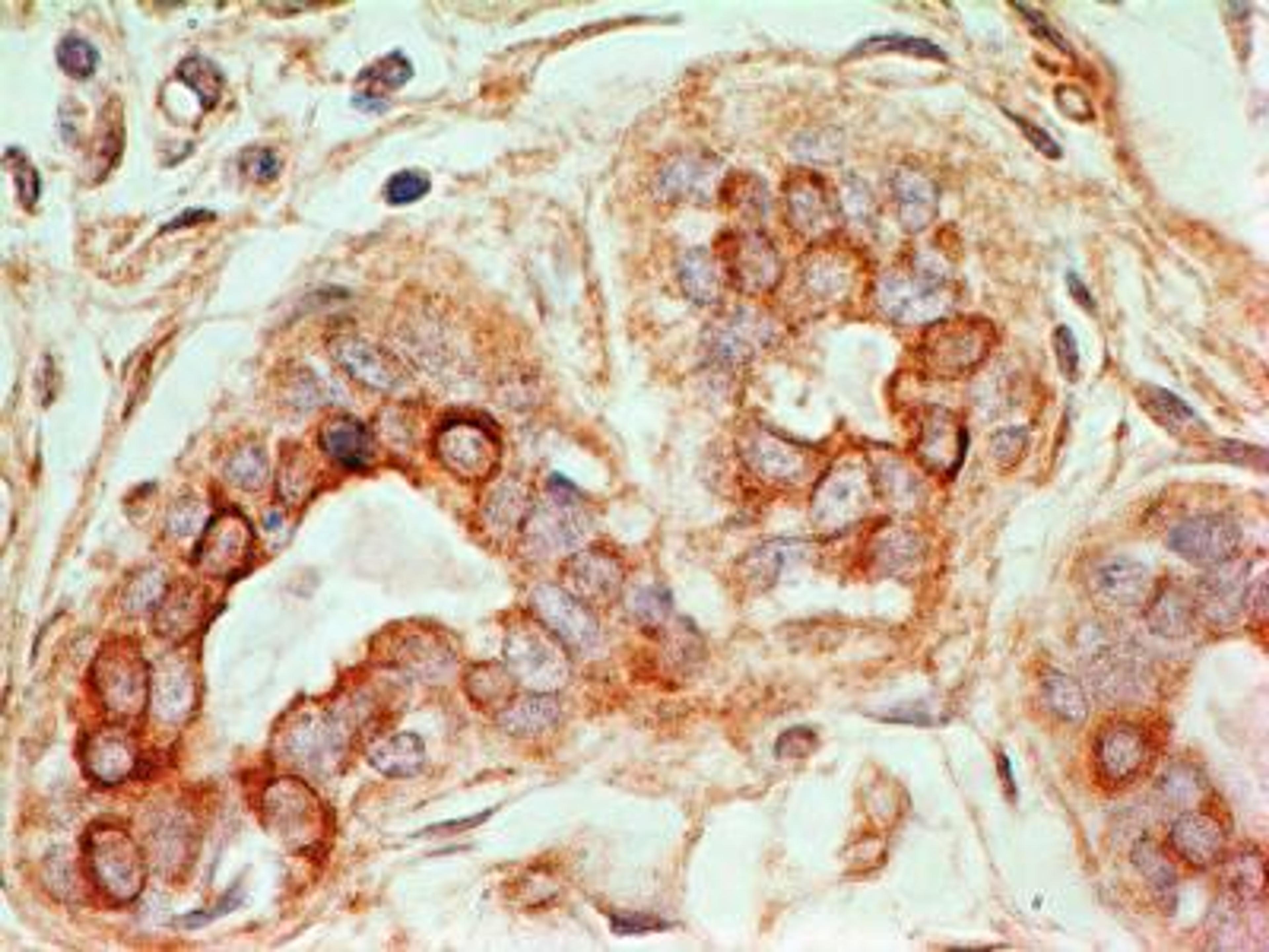 Immunohistochemistry-Paraffin: CD47 Antibody (B6H12.2) [Azide Free] [NBP2-31106] - IHC analysis of formalin-fixed paraffin-embedded tissue section of human normal breast using mouse monoclonal CD47 antibody (clone B6H12.2) at 0.5ug/ml concentration. The ductal/acinar epithelial cells in the breast section developed specific membrane-cytoplasmic staining.