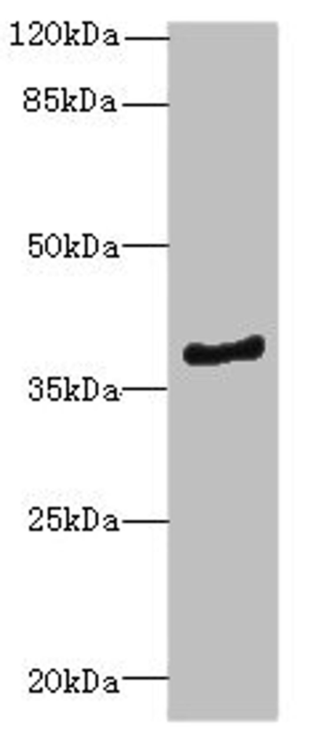 Western blot. All lanes: ELMOD1antibody at 0.7ug/ml + Mouse kidney tissue. Secondary. Goat polyclonal to rabbit IgG at 1/10000 dilution. Predicted band size: 40, 23, 39 kDa. Observed band size: 40 kDa. 