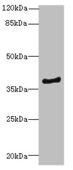 Western blot. All lanes: ELMOD1antibody at 0.7ug/ml + Mouse kidney tissue. Secondary. Goat polyclonal to rabbit IgG at 1/10000 dilution. Predicted band size: 40, 23, 39 kDa. Observed band size: 40 kDa. 