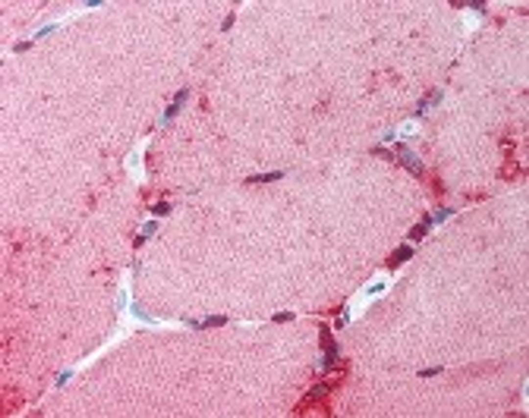 Immunohistochemistry staining of MMP1 in skeletal muscle tissue using MMP1 Antibody.