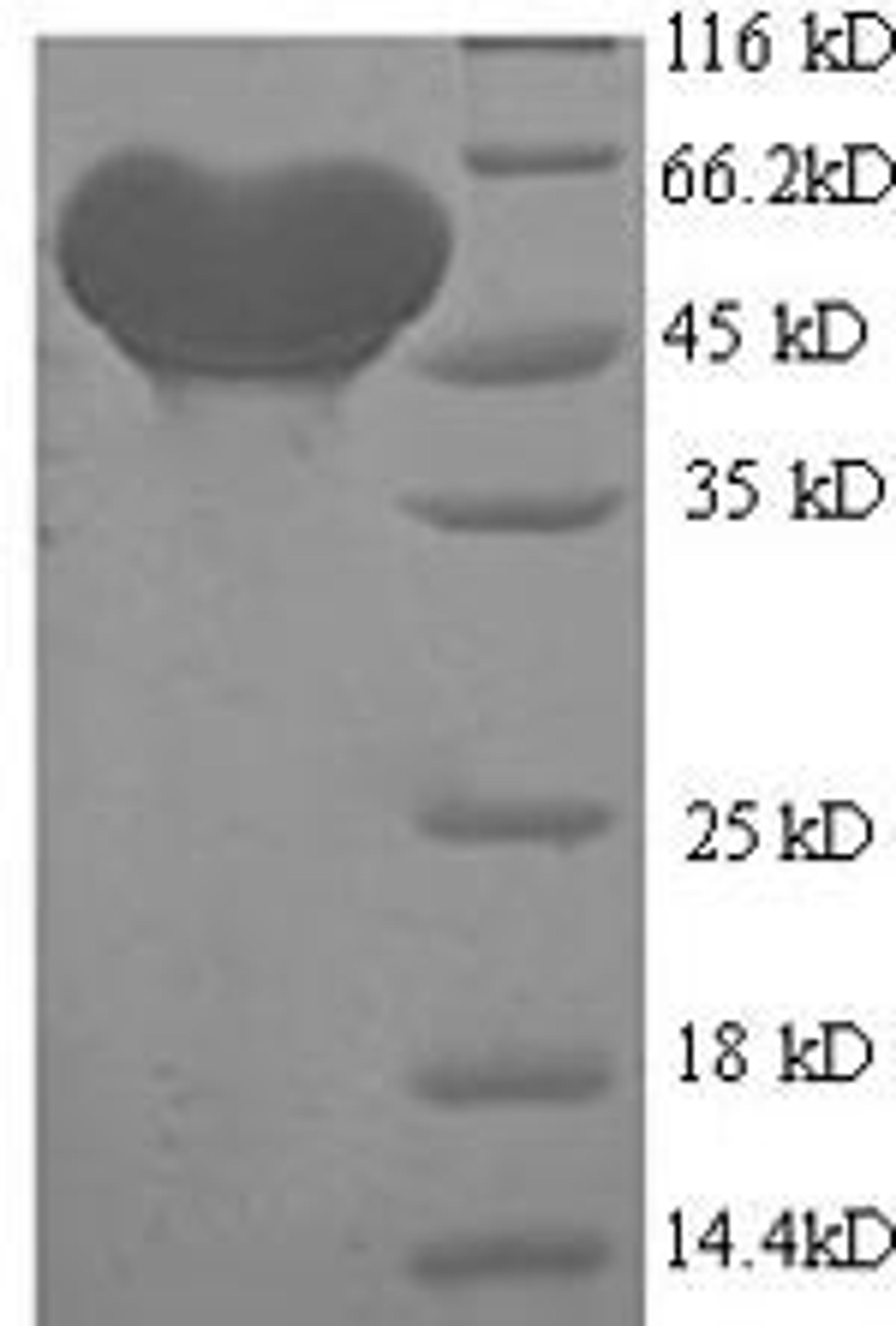 (Tris-Glycine gel) Discontinuous SDS-PAGE (reduced) with 5% enrichment gel and 15% separation gel.