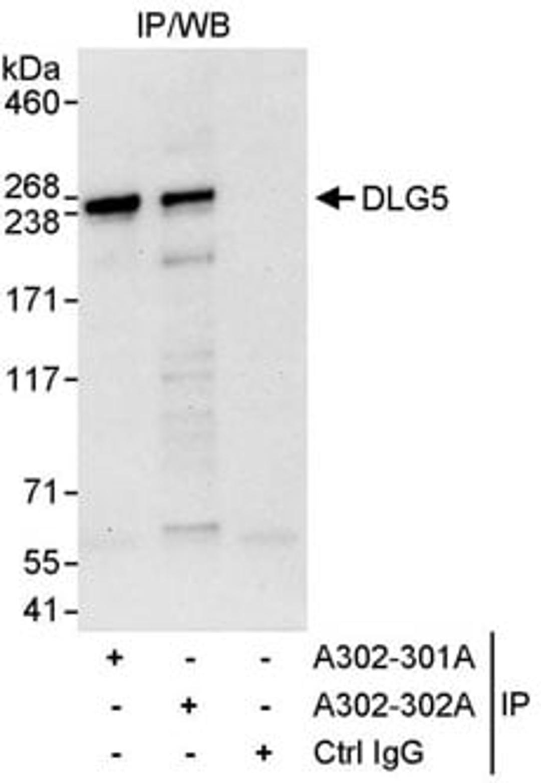 Detection of human DLG5 by western blot of immunoprecipitates.