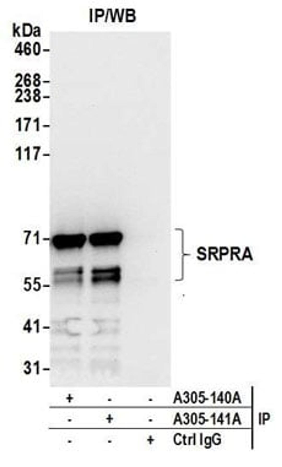 Detection of human SRPRA by western blot of immunoprecipitates.