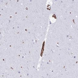 Immunohistochemistry: LIMS2 Antibody [NBP2-31713] - Staining of human cerebral cortex shows strong cytoplasmic positivity in endothelial cells.