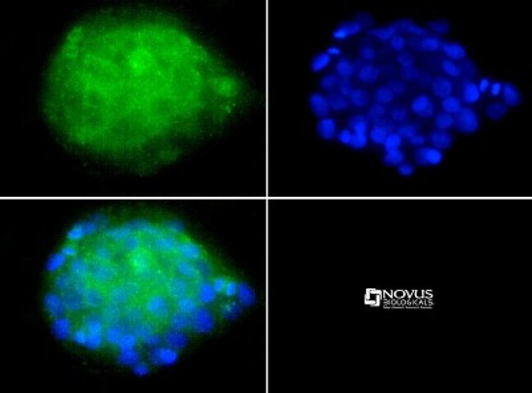 Immunocytochemistry/Immunofluorescence: LDL Receptor Antibody (C7) [NBP1-78159] - Antibody was tested in HepG2 cells with FITC (green). Nuclei were counterstained with Dapi (blue).