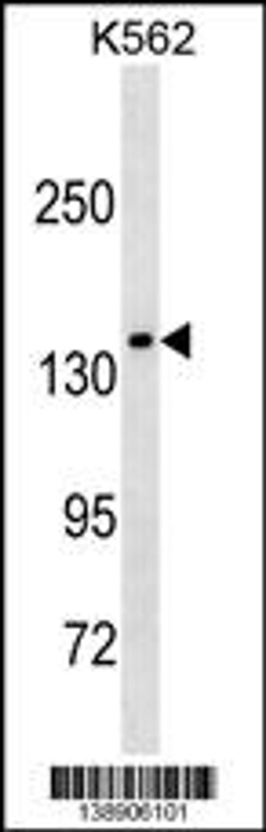 Western blot analysis in K562 cell line lysates (35ug/lane).This demonstrates the MLLT2 antibody detected the MLLT2 protein (arrow).