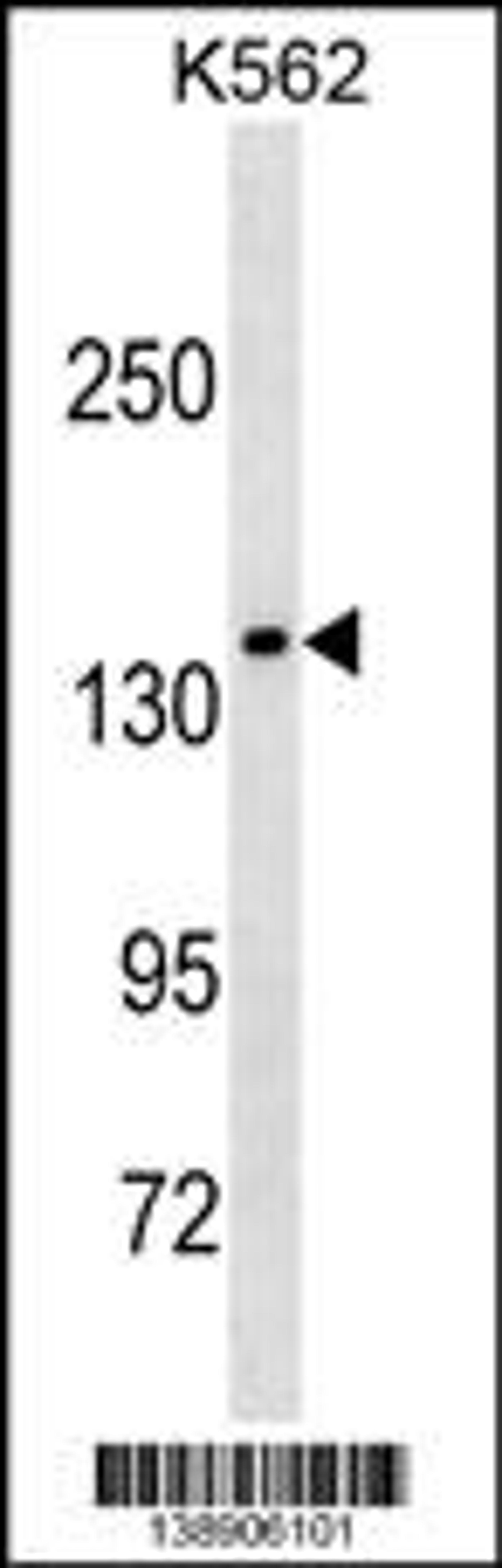 Western blot analysis in K562 cell line lysates (35ug/lane).This demonstrates the MLLT2 antibody detected the MLLT2 protein (arrow).