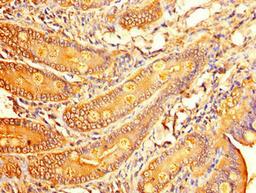 Immunohistochemistry of paraffin-embedded human small intestine tissue using CSB-PA05659A0Rb at dilution of 1:100