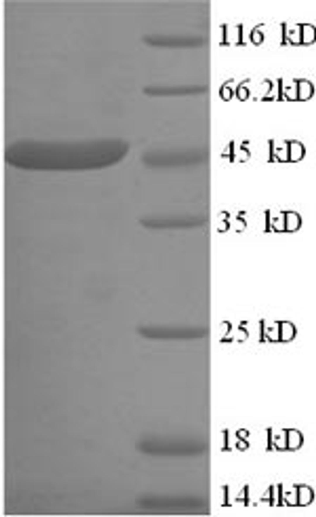 (Tris-Glycine gel) Discontinuous SDS-PAGE (reduced) with 5% enrichment gel and 15% separation gel.