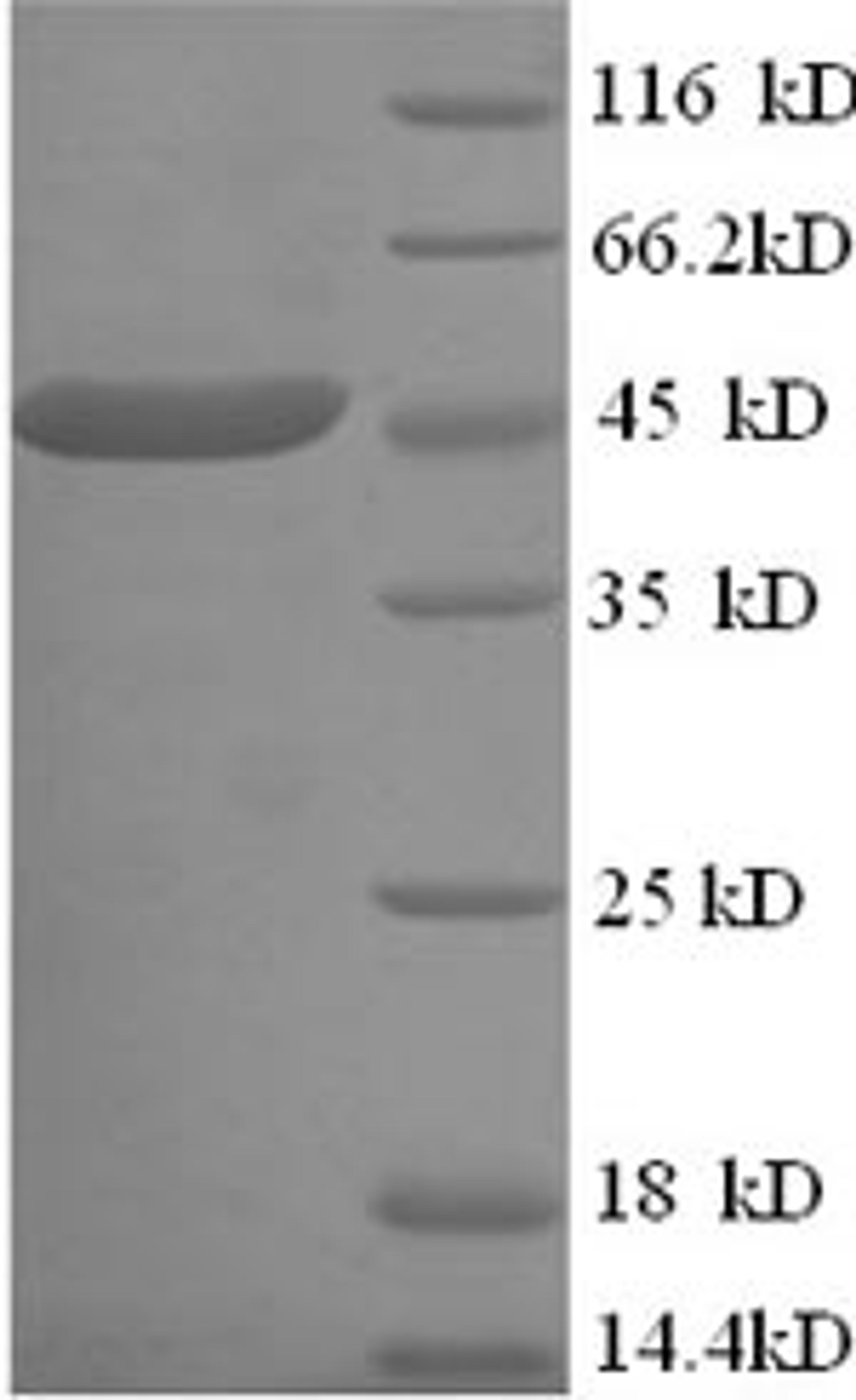(Tris-Glycine gel) Discontinuous SDS-PAGE (reduced) with 5% enrichment gel and 15% separation gel.
