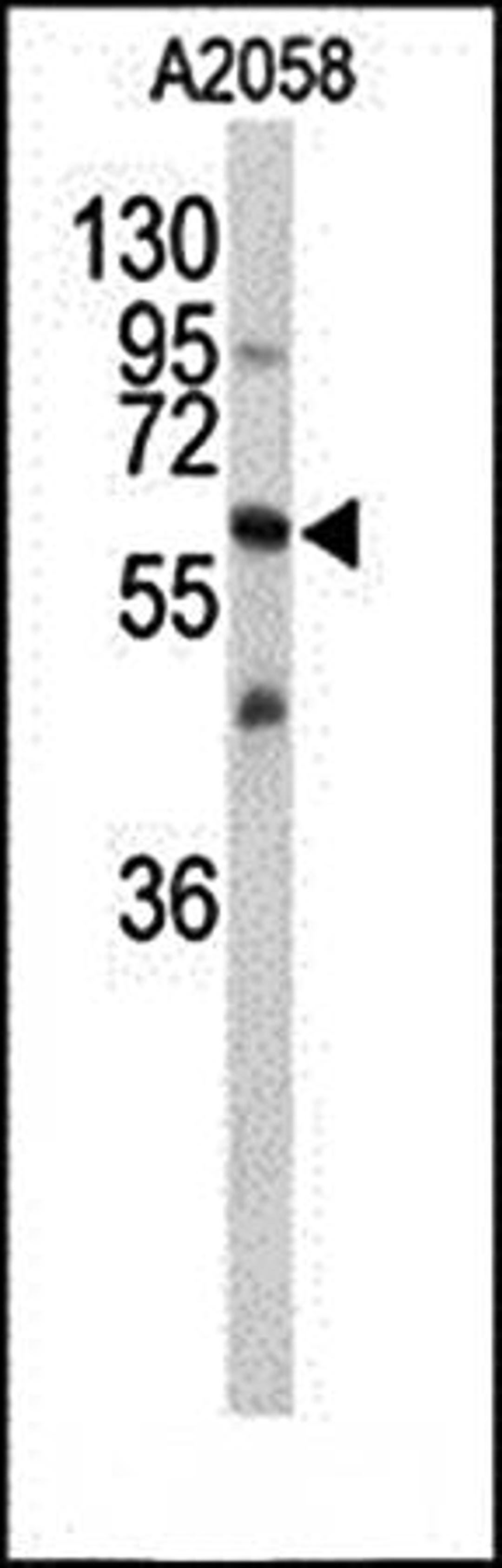 Western blot analysis of CNTN1 antibody in A2058 cell line lysates 