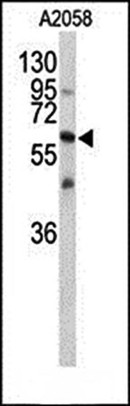 Western blot analysis of CNTN1 antibody in A2058 cell line lysates 