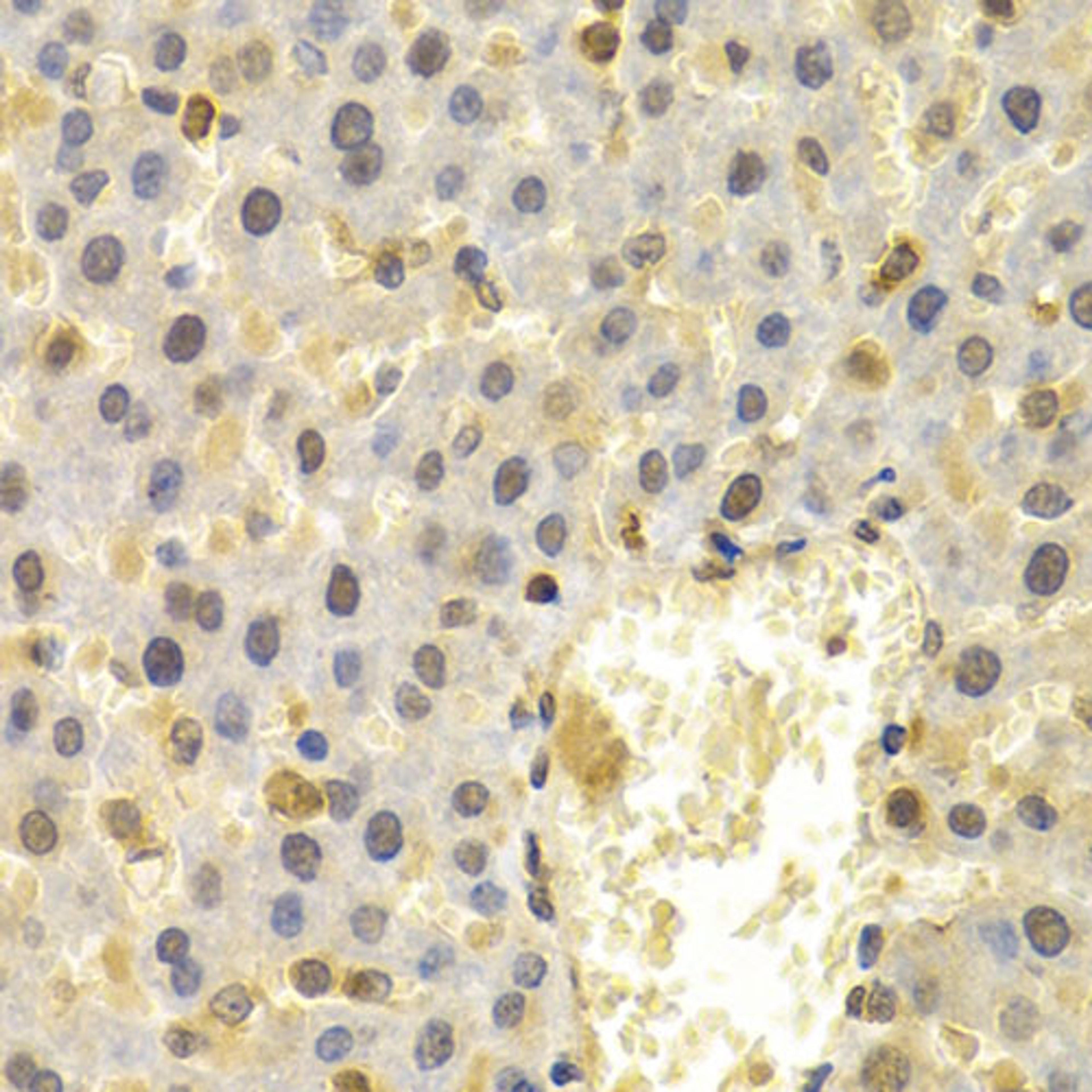 Immunohistochemistry  - UBD antibody (A13397)