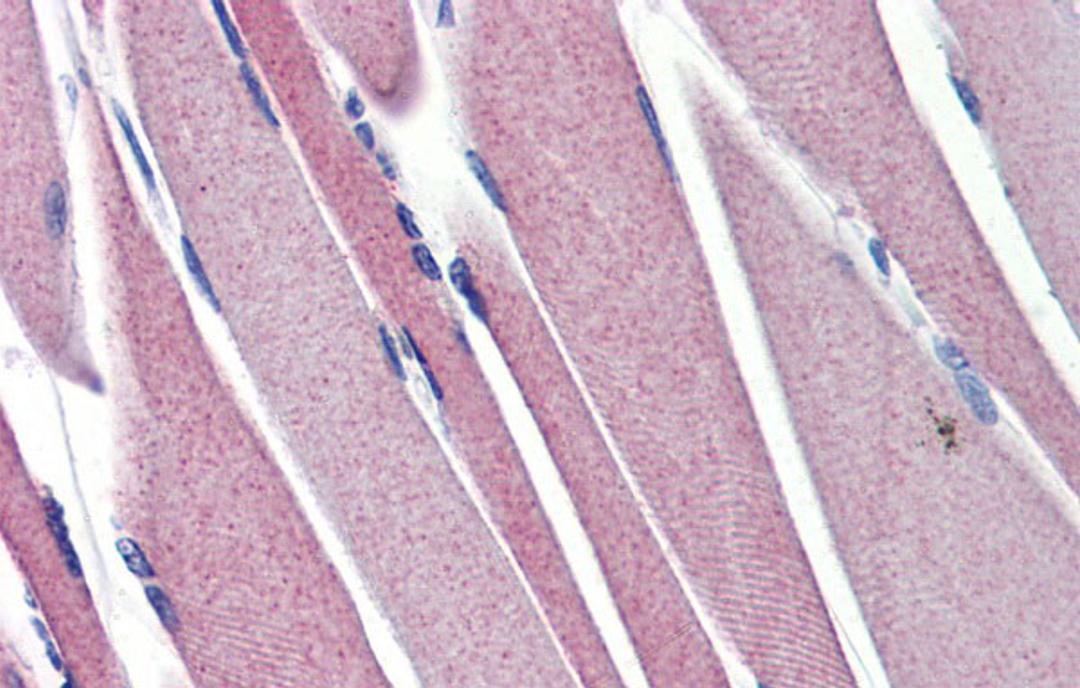 Antibody used in IHC on Human Skeletal Muscle at 5.0 ug/ml.