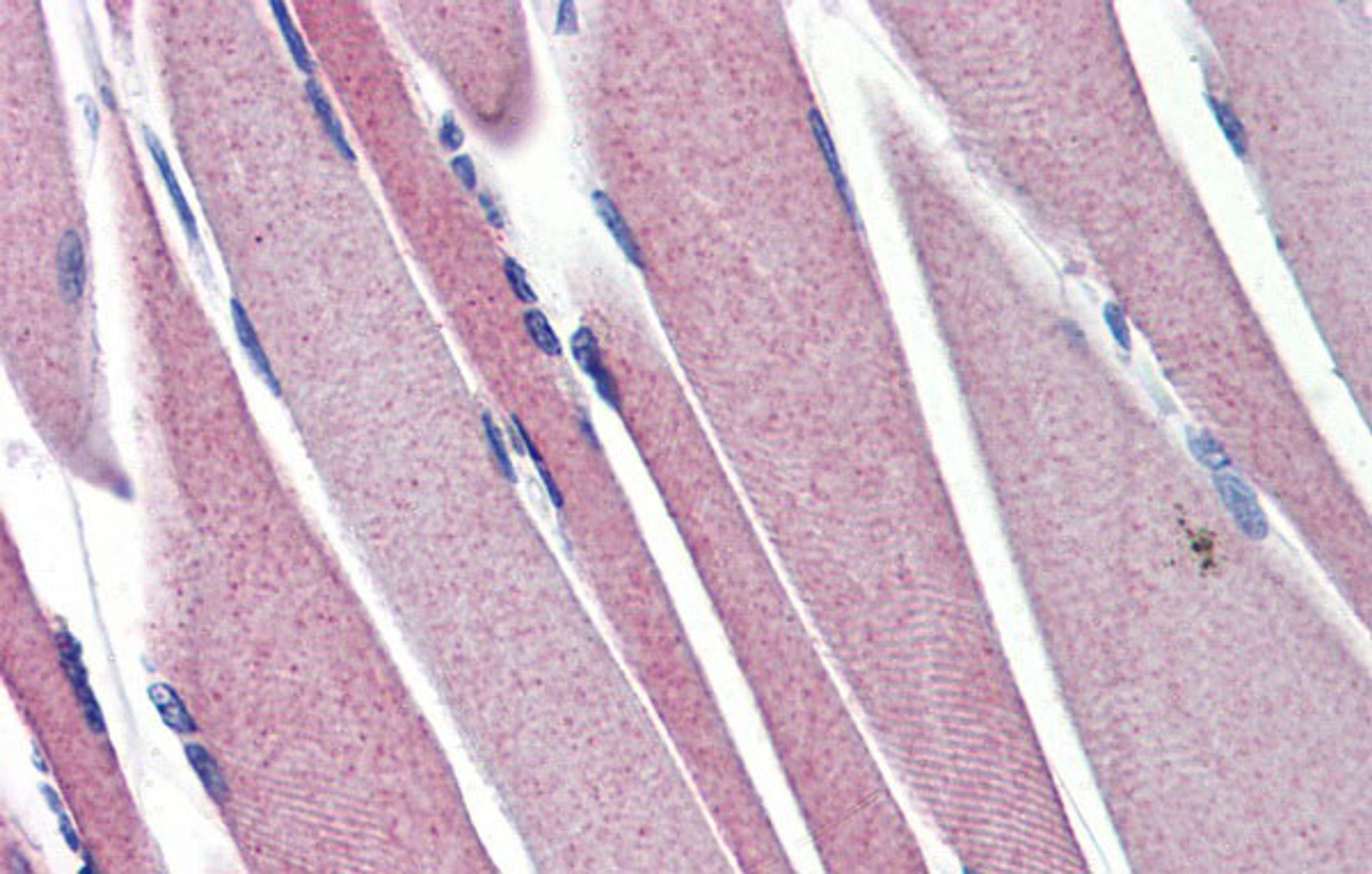 Antibody used in IHC on Human Skeletal Muscle at 5.0 ug/ml.