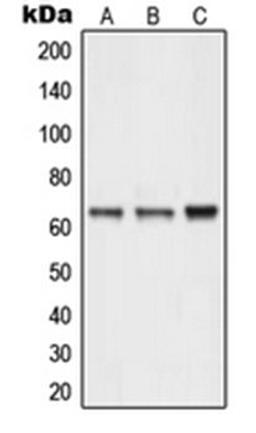 Western blot analysis of Y79 (Lane 1), MCF7 (Lane 2), HepG2 (Lane 3) whole cell lysates using NEURL antibody