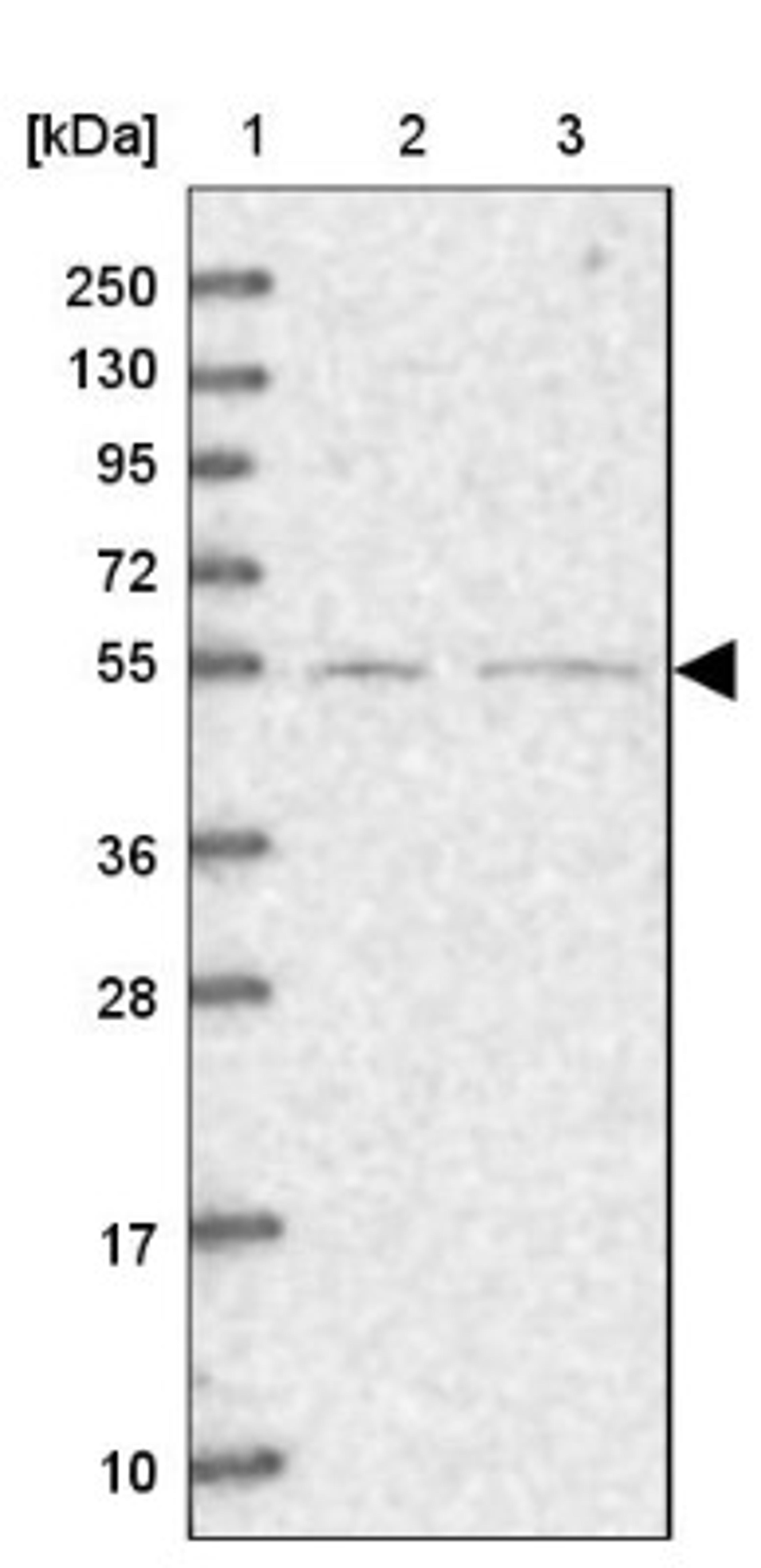 Western Blot: SFRS12 Antibody [NBP1-87993] - Lane 1: Marker [kDa] 250, 130, 95, 72, 55, 36, 28, 17, 10<br/>Lane 2: Human cell line RT-4<br/>Lane 3: Human cell line U-251MG sp