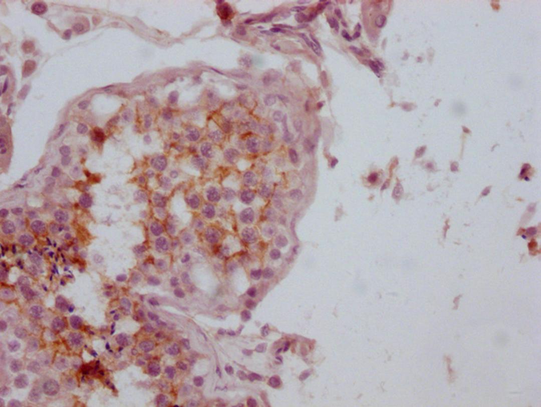 IHC image of CSB-MA153712 diluted at 1:100 and staining in paraffin-embedded human testis tissue performed on a Leica BondTM system. After dewaxing and hydration, antigen retrieval was mediated by high pressure in a citrate buffer (pH 6.0). Section was blocked with 10% normal goat serum 30min at RT. Then primary antibody (1% BSA) was incubated at 4°C overnight. The primary is detected by a Goat anti-mouse IgG polymer labeled by HRP and visualized using 0.05% DAB.