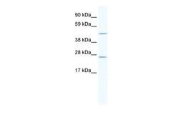 Antibody used in WB on Human Thymus at 2.5 ug/ml.