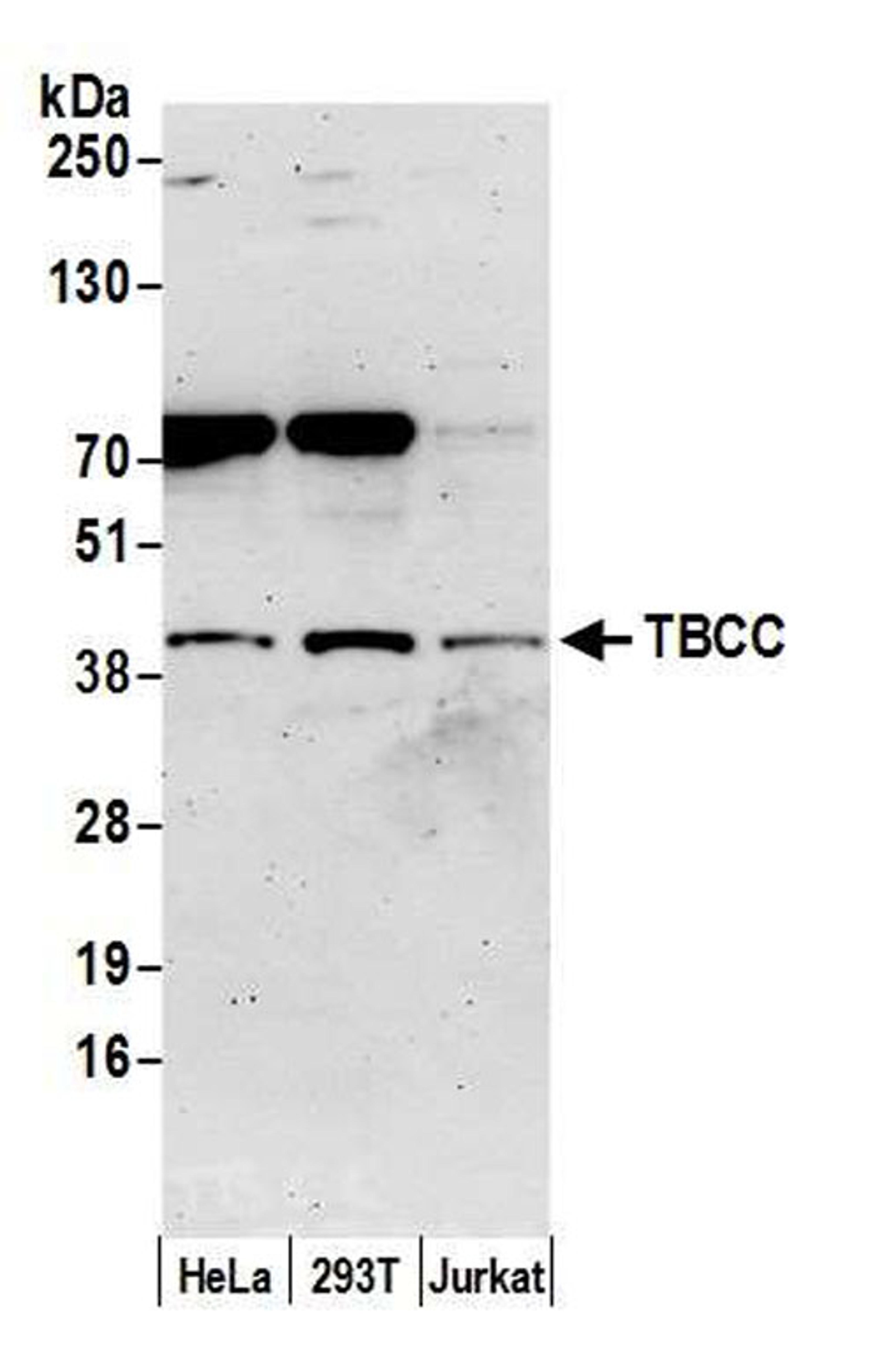 Detection of human TBCC by WB.