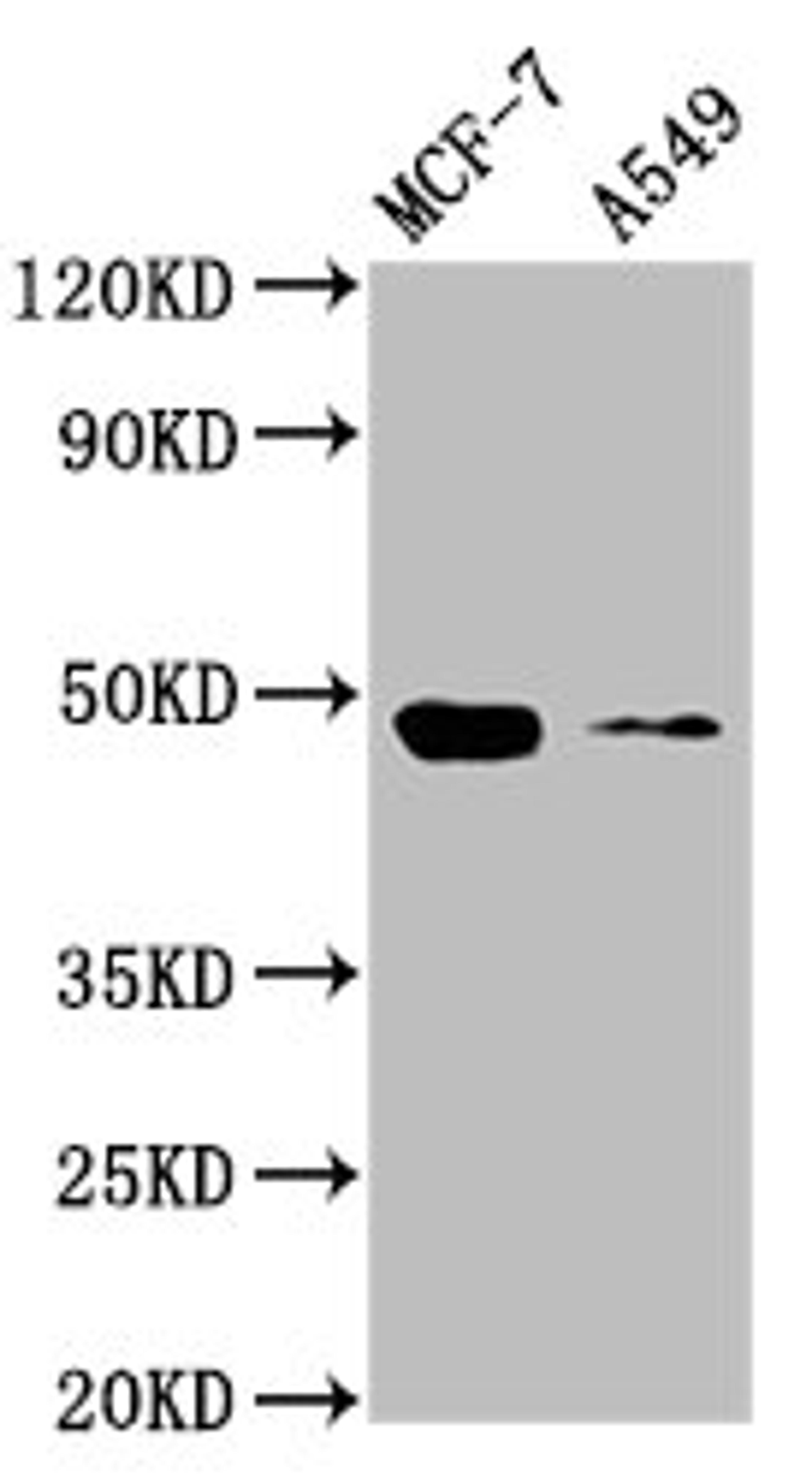 Western Blot. Positive WB detected in: MCF-7 whole cell lysate, A549 whole cell lysate. All lanes: SMAD3 antibody at 4µg/ml. Secondary. Goat polyclonal to rabbit IgG at 1/50000 dilution. Predicted band size: 49, 44, 36, 26 kDa. Observed band size: 49 kDa
