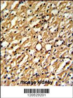 Formalin-fixed and paraffin-embedded mouse kidney reacted with DDAH1 Antibody , which was peroxidase-conjugated to the secondary antibody, followed by DAB staining.