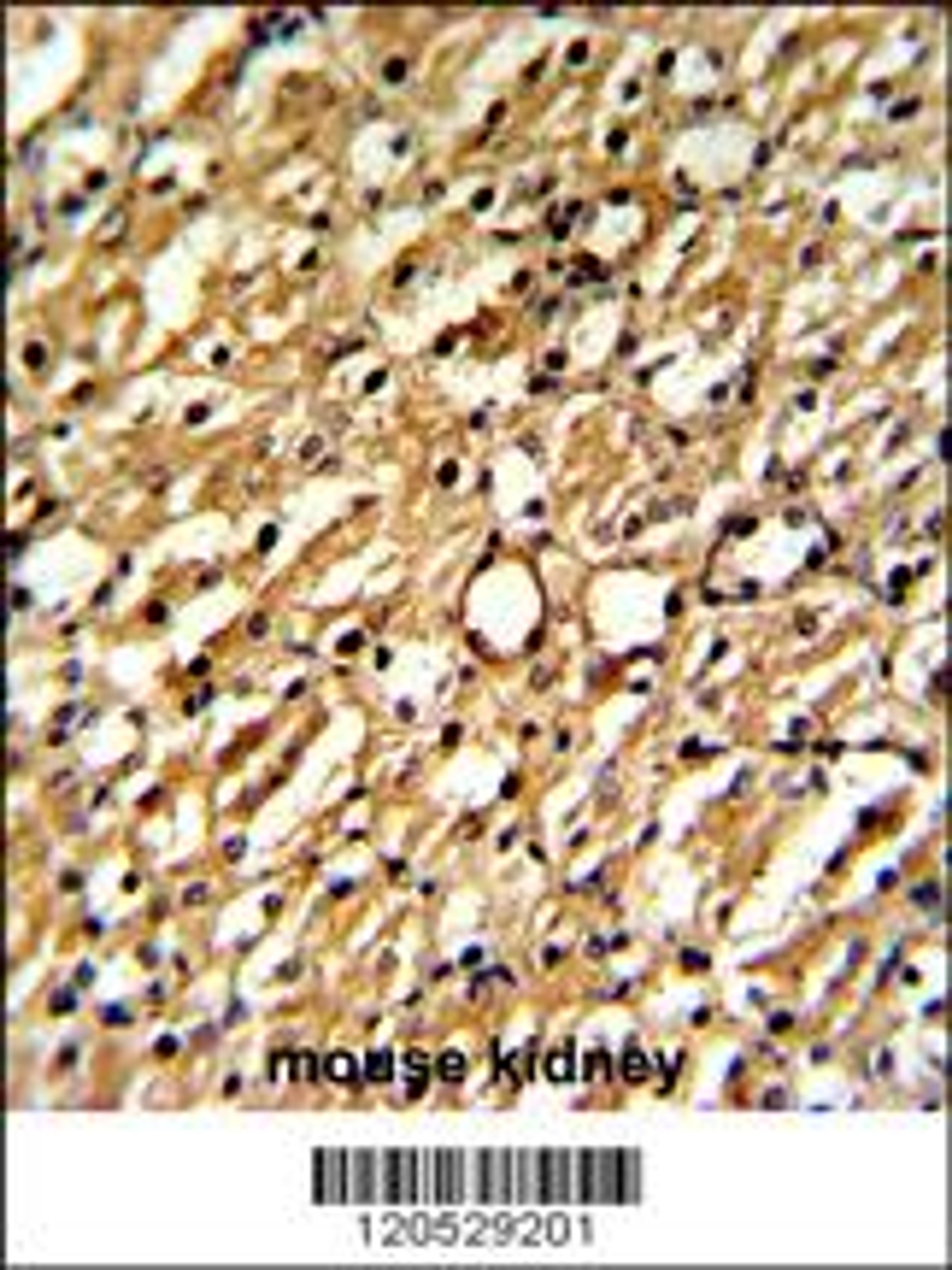 Formalin-fixed and paraffin-embedded mouse kidney reacted with DDAH1 Antibody , which was peroxidase-conjugated to the secondary antibody, followed by DAB staining.