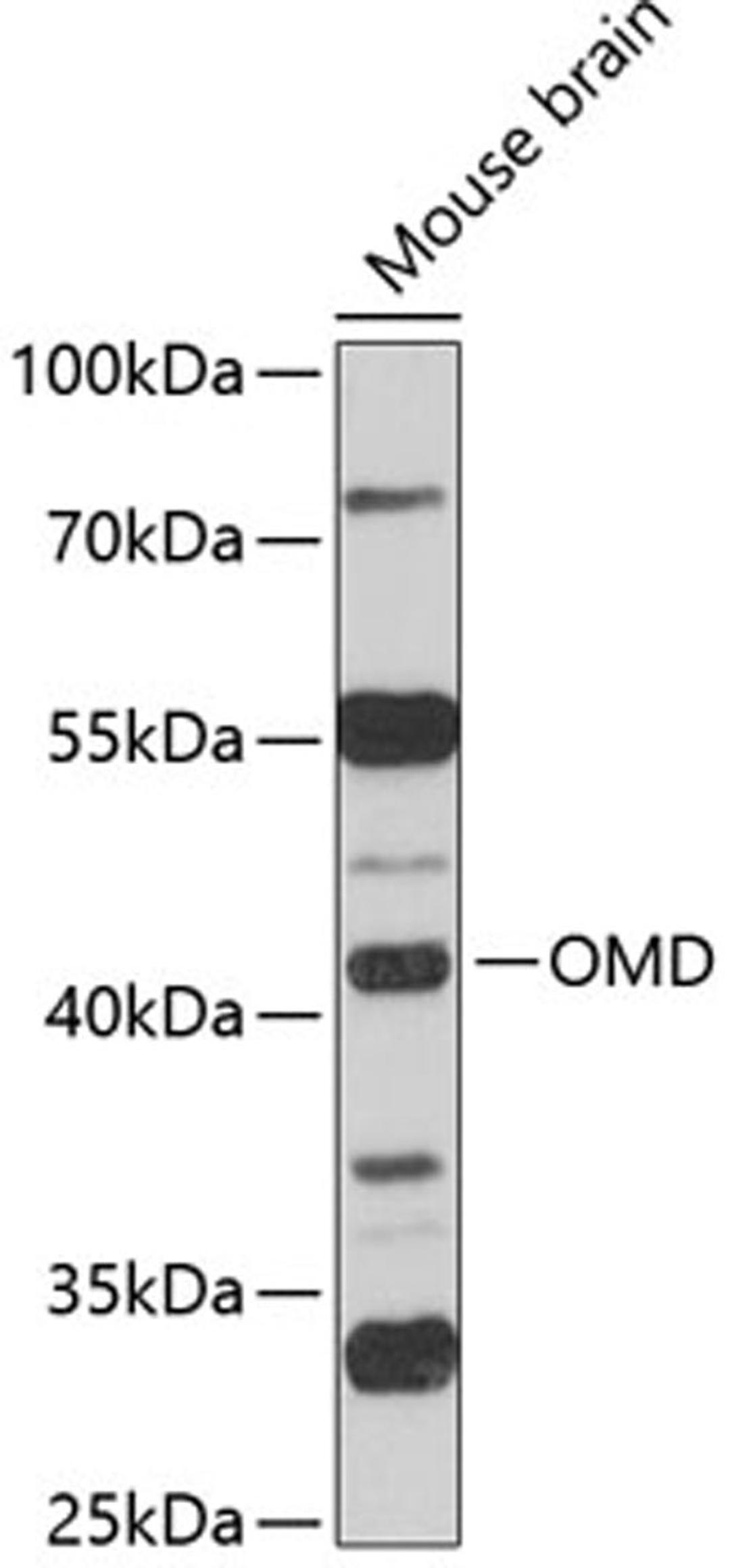 Western blot - OMD antibody (A12256)