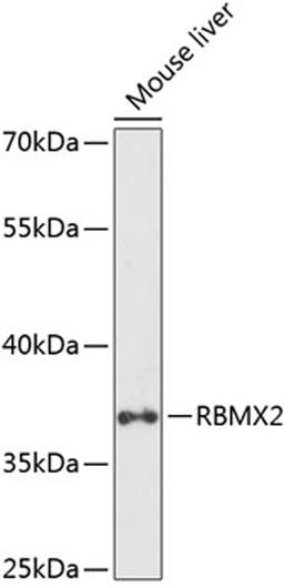 Western blot - RBMX2 antibody (A14321)