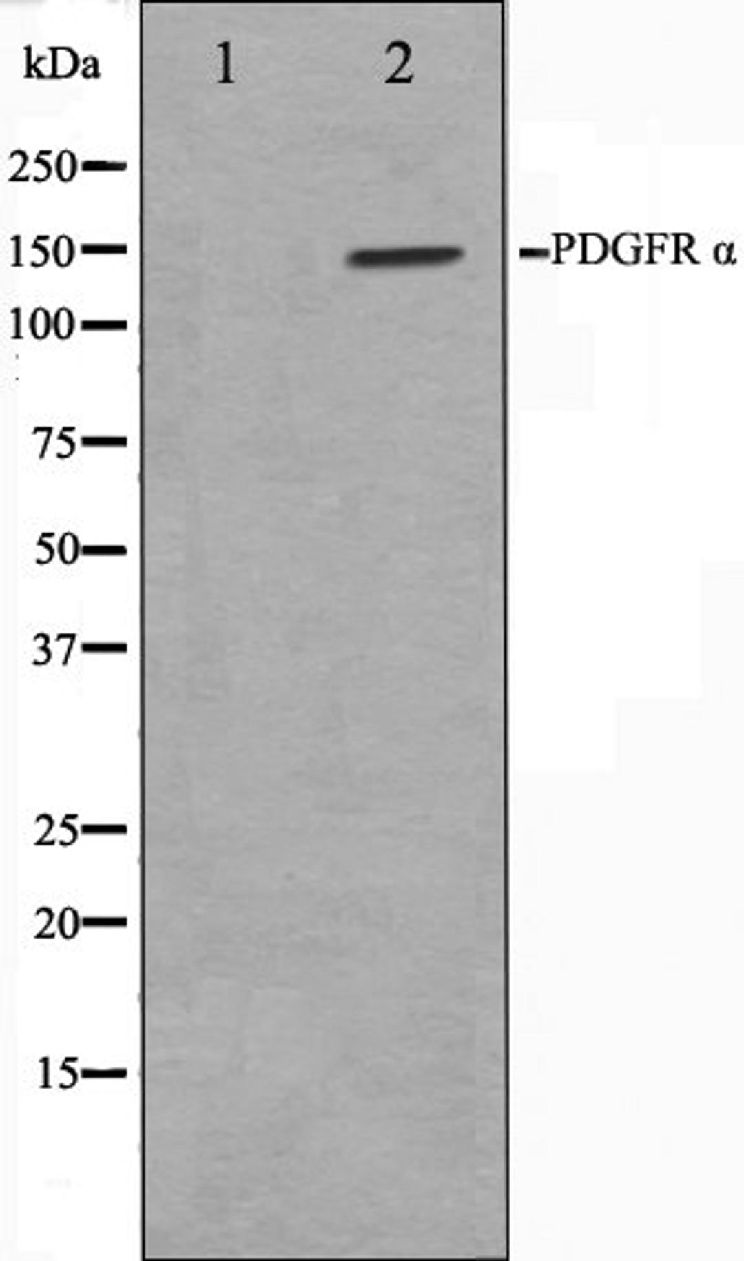 Western blot analysis of 293 cell lysate using PDGFRalpha antibody