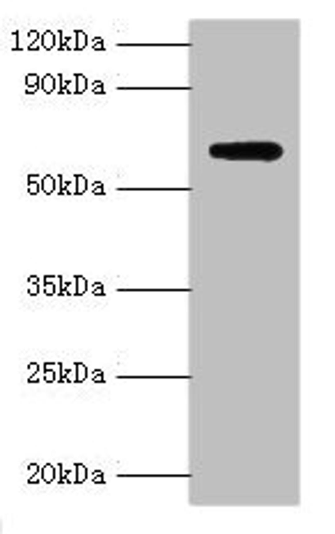 Western blot. All lanes: Anti-Muellerian hormone type-2 receptor antibody at 15ug/ml + Mouse brain tissue. Secondary. Goat polyclonal to rabbit IgG at 1/10000 dilution. Predicted band size: 63, 53, 52 kDa. Observed band size: 63 kDa. 