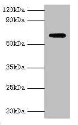 Western blot. All lanes: Anti-Muellerian hormone type-2 receptor antibody at 15ug/ml + Mouse brain tissue. Secondary. Goat polyclonal to rabbit IgG at 1/10000 dilution. Predicted band size: 63, 53, 52 kDa. Observed band size: 63 kDa. 